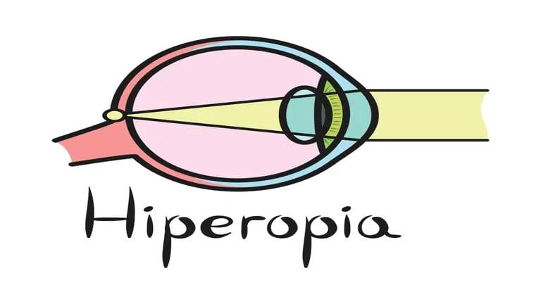 Hyperopia Signs
