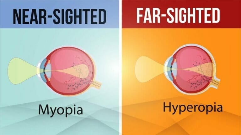 What Is The Difference Between Myopia And Hypermetropia